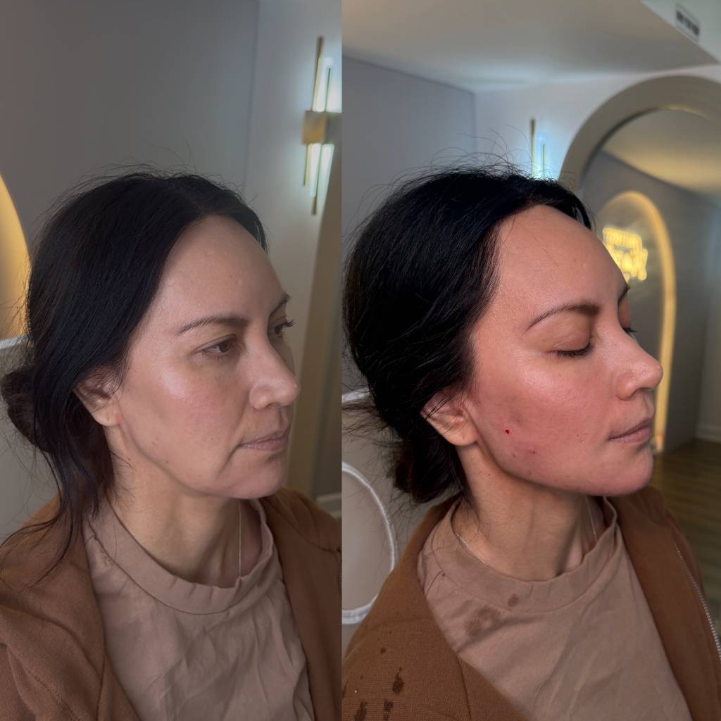 Liquid face lidt (1)